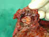 Madisons tumor divided looking at inside yellow part is center with brown tumor around it.jpg (421198 bytes)